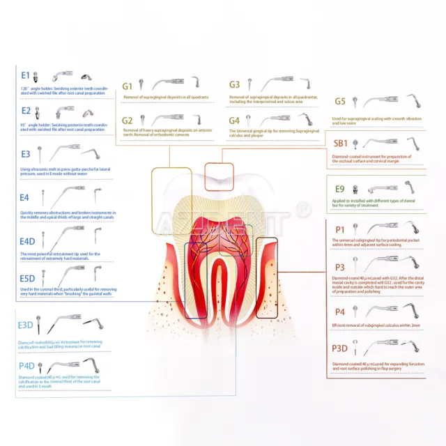 19 types d'échelle dentaire à ultrasons échelle endo période pointe G P E conique adapté pour EMS 2