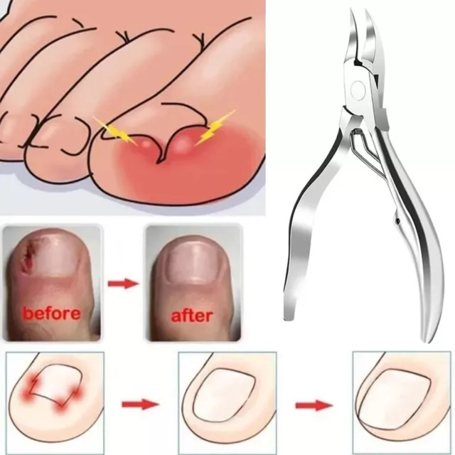 Nuovo Strumento Professionale Per Rimuovere La Manicure Con Pinze Per A