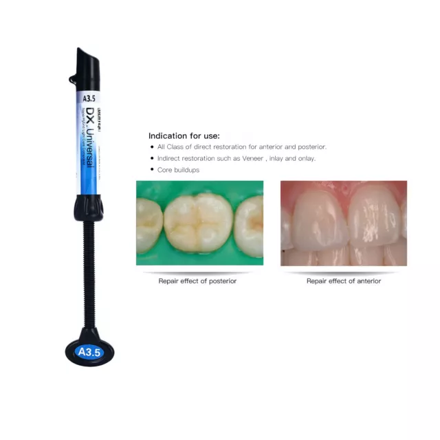 DENTEX Dental Light Cure Composite Resin Anterior/Posterior Restorations A3.5