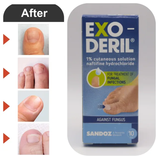 Exoderil 1% 10 ml tratamiento antifúngico de uñas solución de hongos uñas dedos 3