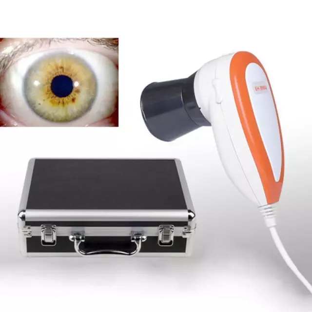 5.0 MP USB Eyes Iris Analyzer Iridology camera Pupilometer+Software FDA New 3