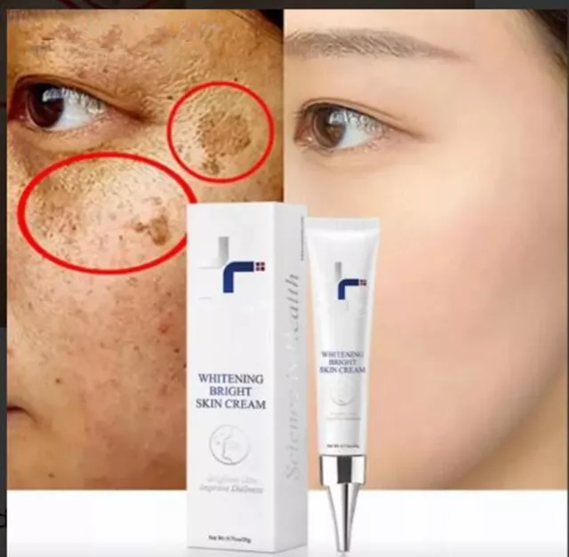 Removedor De Manchas En La Piel, Reduce Pecas Blanquea Cara