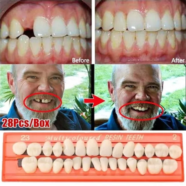 Resin Temporary Crown Simulation Teeth Resin Acrylic Tooth Tool Teeth Veneers