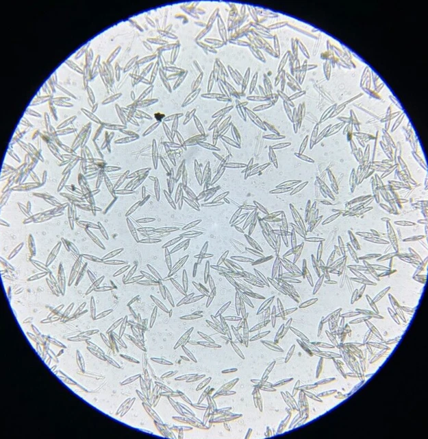 19th c J.D. Moller Microscope Slide Diatom Slovakia Stauroneis Gracilis Ehr.