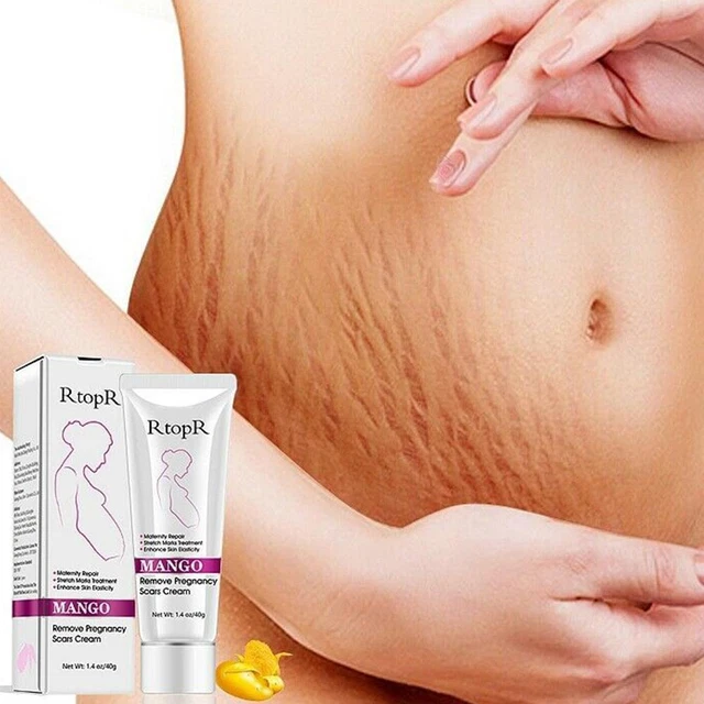 40 ml RtopR Mango Eliminar Cicatrices Embarazo Crema Acné Hot B9S7 Crema I8Q9 C9S4