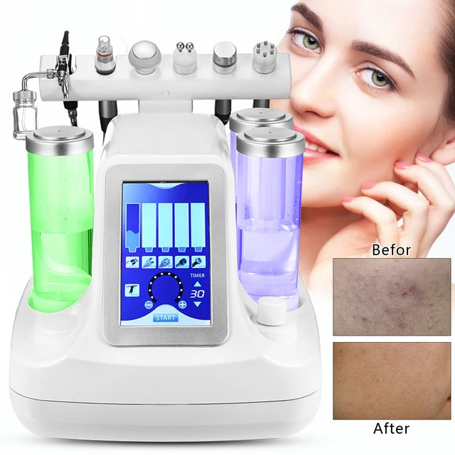 6 in 1 RF Reinigungspflege Ultraschall Facial Cleansing Schönheitsinstrument