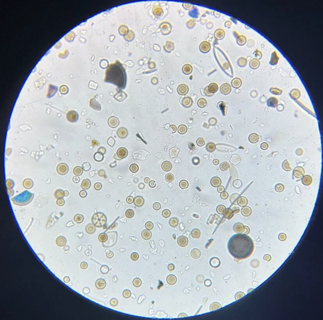 J.D. Moller Microscope Slide Diatom Marsh Ground Wedel Germany Gold Medal 1869