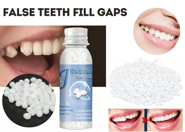 Temporary Tooth Repair Kit - Resin False Teeth & Glue For Gaps, Chips, Or Missing Teeth