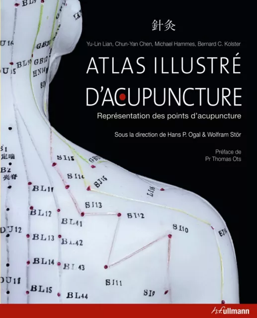 rare Atlas illustré d'Acupuncture . Hans P. Hogal & Wolfram Stör - ed. ullmann