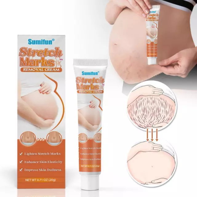 Stretch Mark Remover Repair Cream For Postpartum Pregnancy Care Scar NEW M5Q1