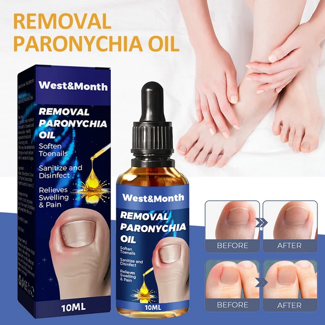 2023 Bestes Deutsches Toenailplus Nailprop Anti Paronychia Relief Oil Usa ∑