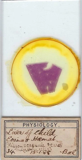 Devascularization Histology HUMAN LIVER OF Child Histology Microscope Slide (1888) £68.39 - PicClick UK