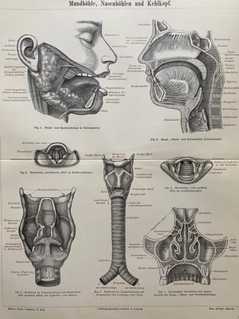 antike Grafik Medizin/Anatomie: 2 Grafiken Ohr, Mund, Nase & Kehlkopf 1900 3