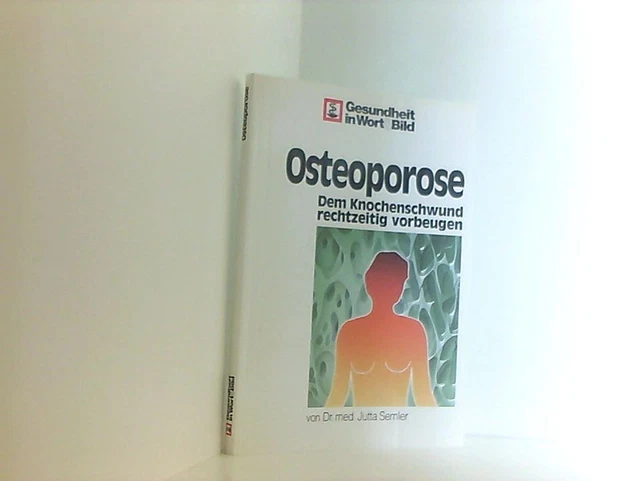 Osteoporose. Dem Knochenschwund rechtzeitig vorbeugen. Semler, Jutta: