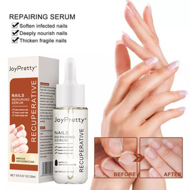 Gfouk 7 Tage Nagelwachstums- Und Stärkungsserum – 丷