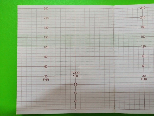 Carta Per Registrazione Medica Carta Termica Da Registrazione 110mm X 20m - Per Stampante ECG CONTEC 600G, Confezione Nuova Carta Termica ECG - Foto 3