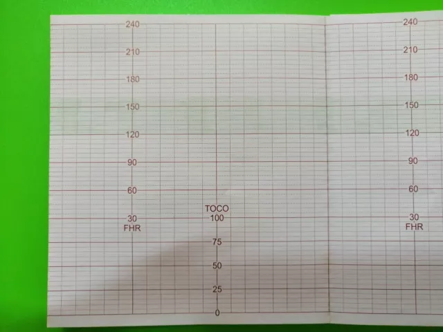 Carta Termica per Cardiotocografo Sonicaid Meridian 800 - 143 mm x
