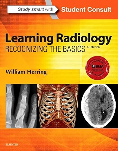 Learning Radillogy LEARNING RADIOLOGY: RECOGNIZING the Basics £5.98 - PicClick UK