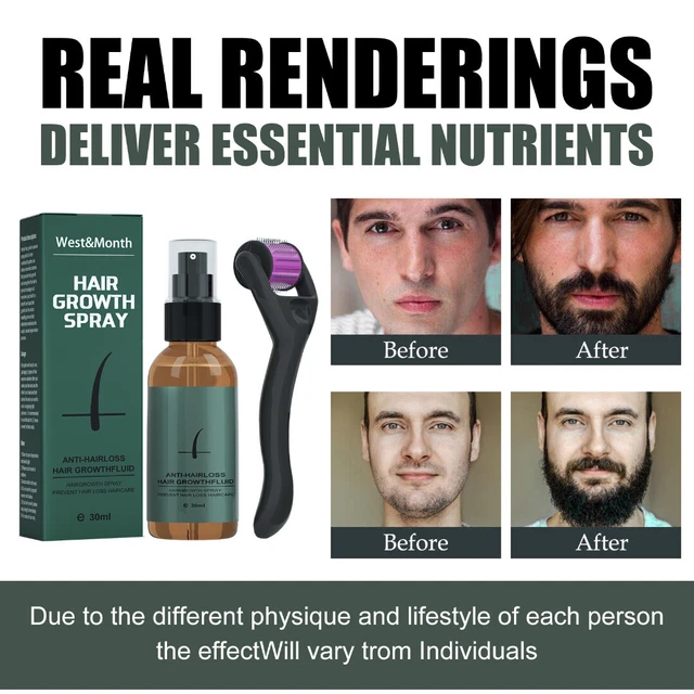 Kit de crecimiento de barba para hombre - Novios barba bigote aumenta el crecimiento del cabello aceite de barba,