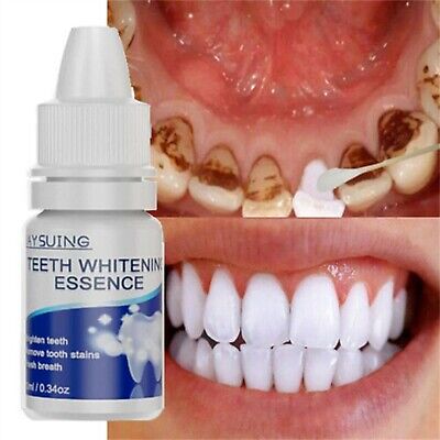 Esencia blanqueadora dental gel de suero higiene oral cuidado dental eliminar placa limpieza N