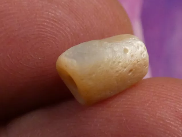Ancient Roman Syrian Mother Of Pearl Bead 10.4-7.2 Mm Patina Lustre Irridescent