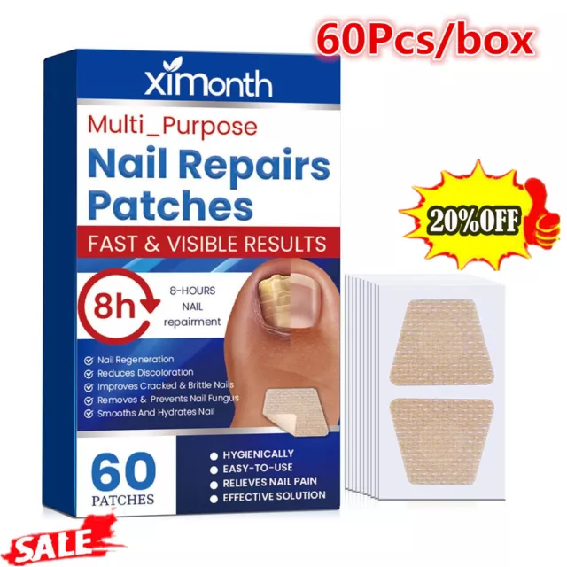 60x Anti Fungal Nail Treatment Patches Toe Fungus Onychomycosis Repair Sticker-