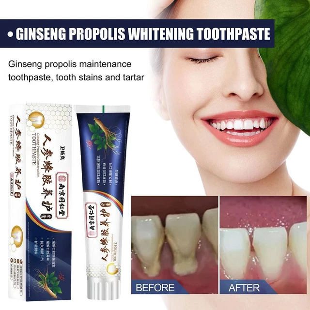 Propolis Ginseng Conservation Toothpaste，Loose Teeth Care Toothpaste  HOT