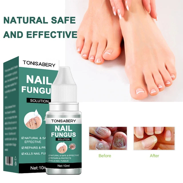 10 ml liquido antibatterico efficace trattamento unghie riutilizzabile