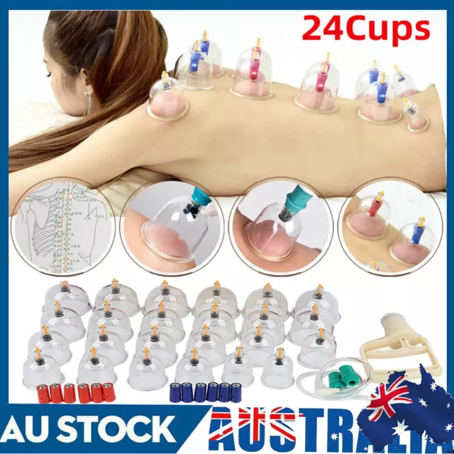 24x Cups Vacuum Cupping Set Massage Acupuncture Kit Suction Massager Pain Relief