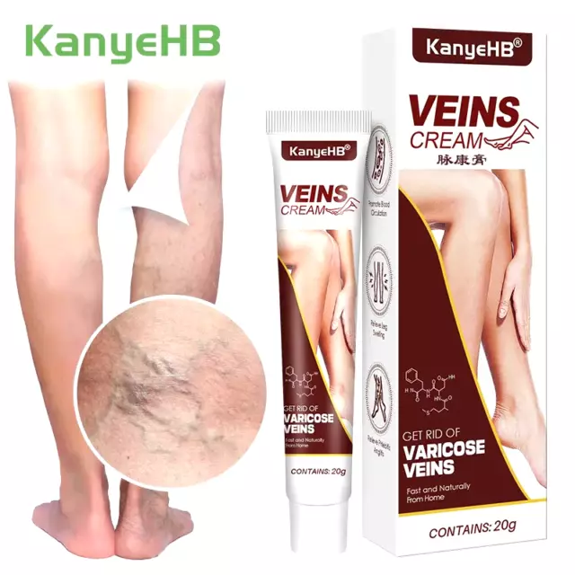 Variscose Vein Cream / Super Crème Traintement De La Varices Veine D'araignée