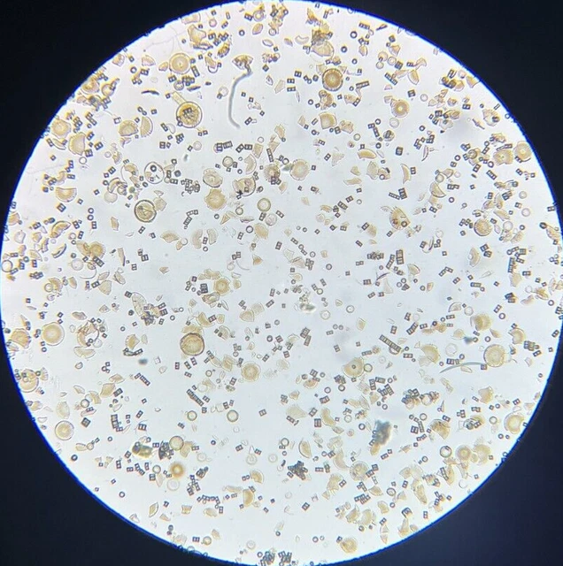 J.D. Moller Microscope Slide Diatom Fossil Carcon California USA 1869 Gold Medal