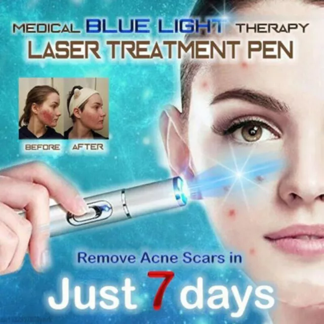 KD-7910 Bleu Lumière Acné Varices Souple Cicatrice Ride Retrait Laser Stylo Box