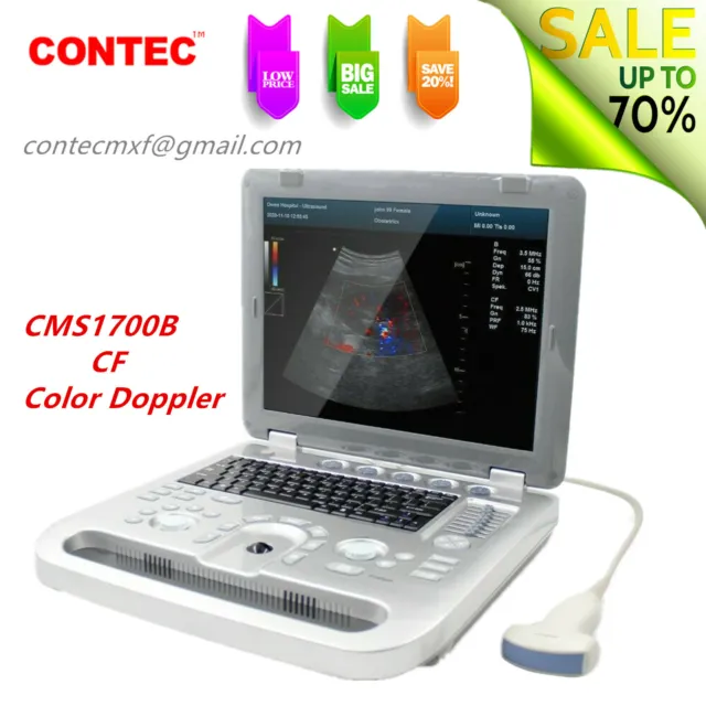 CMS1700B Color Doppler CF Ultrasound Scanner ultrasonic diagnostic device Convex