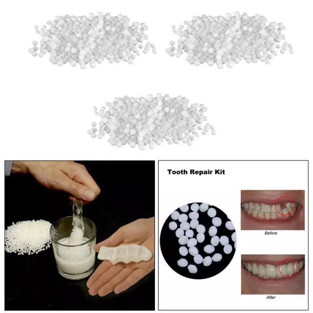 Thermal Fitting Beads Teeth Veneers Moldable Temporary Tooth Repair Kit