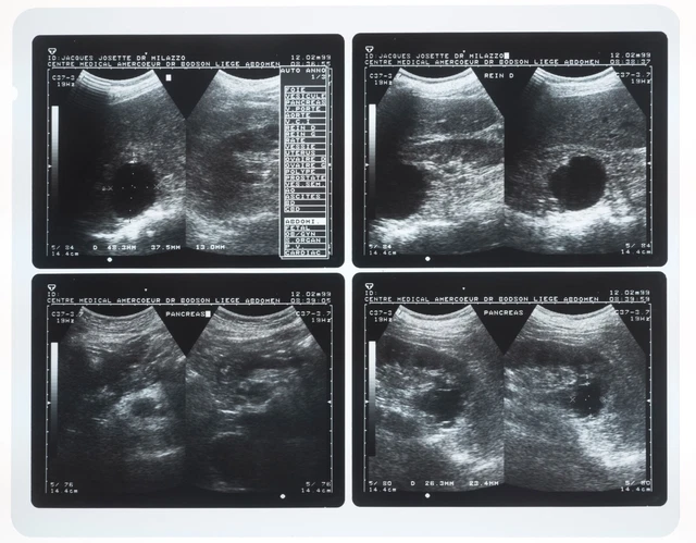 GENUINE VINTAGE HOSPITAL Human X-Ray Ultrasound Scan Original Acetate ...
