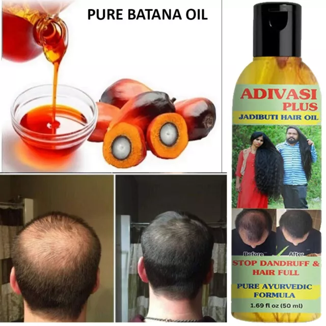 Hair Growth Miracle Batana Oil / 100% Pure Organic
