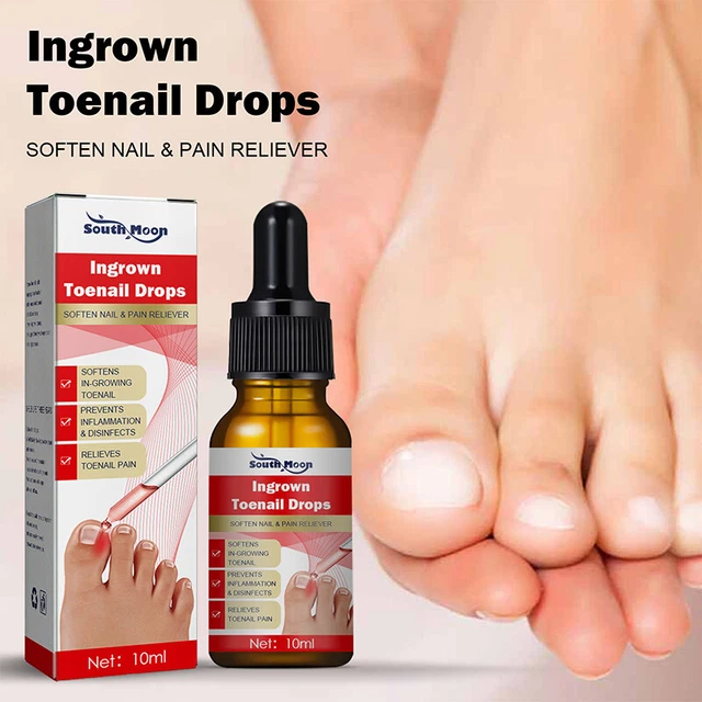 Incarné Ongle Traitement Serum Correction Récupérer Huile Analgésique Cha,