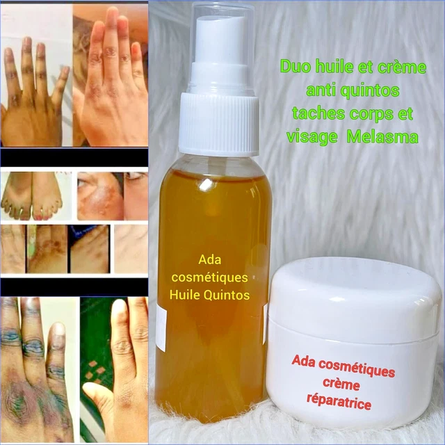 Huile & Crème Anti-Taches QUINTOS 4 En 1 - Action Rapide Pour Corps Et Visage - ADA Cosmétiques