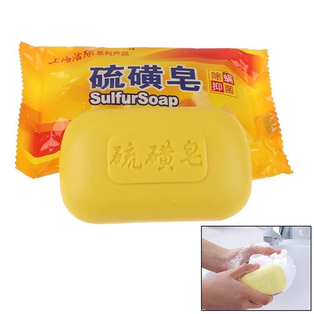 Saponi zolfo Shanghai acne brufoli punti neri prurito fungo scabbia