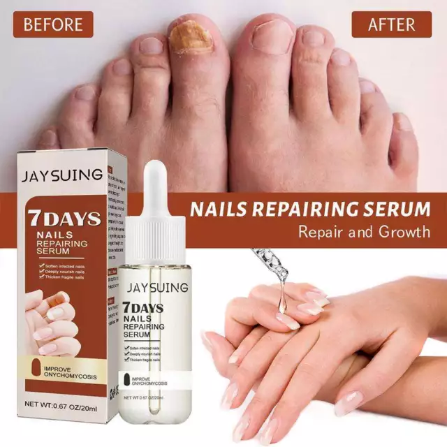 GFOUK 7 Tage Nagelwachstum und Stärkung Serum, Nagelwachstum und Stärke; Serum/