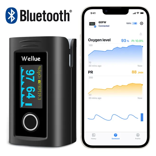 CE approval Pulse Oximeter with free App Blood Oxygen Heart Rate Monitor SpO2