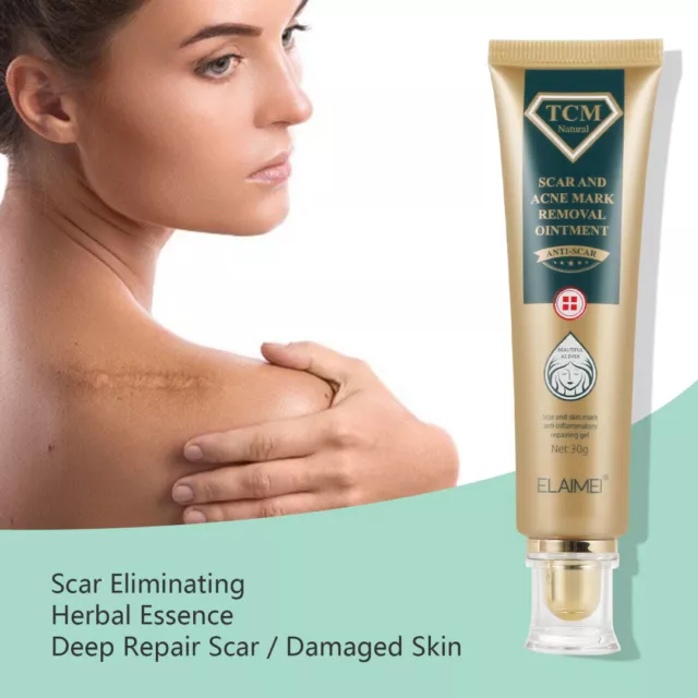 TCM Scar And Acne Mark Removal Gel Cream Treatment Anti Stretch Skin Spots Marks