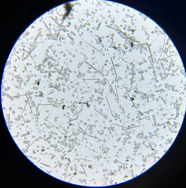 19th c J.D. Moller Microscope Diatom Slide Melosira Varians Kg.