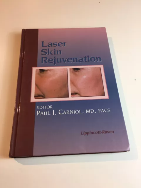 Laser Skin Rejuvenation