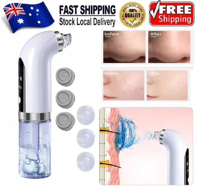 Electric Blackhead Remover Vacuum Pore Acne Face Rechargeable Facial Suction Kit