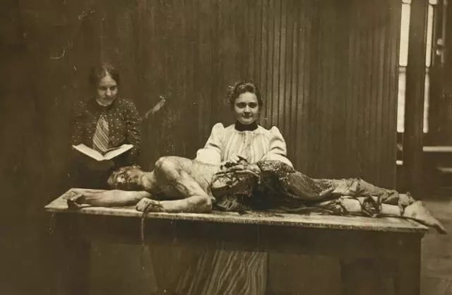 Antique Medical Autopsy Photo 181b Oddleys Strange & Bizarre