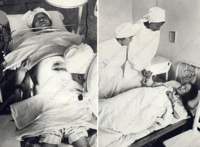 1974 PECHINO Agopuntura taglio cesareo Mildred Scheel Fotografia