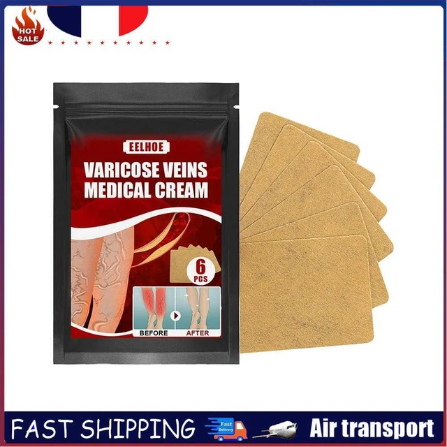 Effective Varicose Vein Relief Patch Body Leg Vasculitis Phlebitis Spider