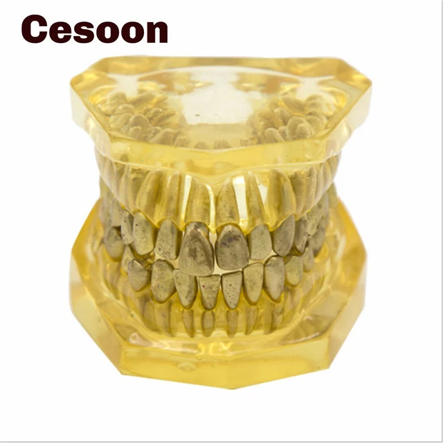 DENTAL TEETH MODEL Orthodontic Practice Model of Tooth Extraction