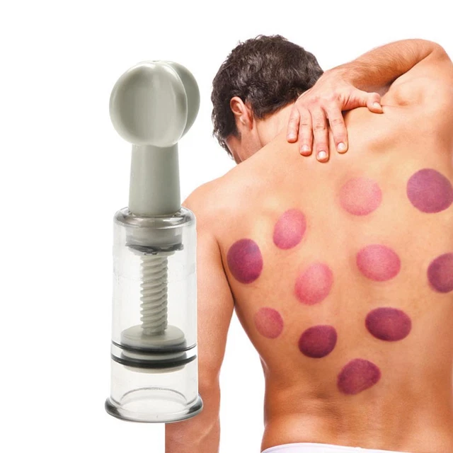 Maniglia Rotante Aspirazione Coppetta Aspirazione Terapia Familiare Tazze (2,5 cm) -de